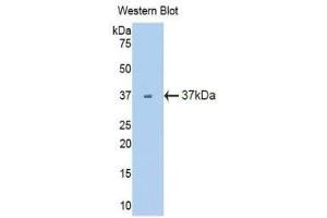 Western Blotting (WB) image for anti-Fms-Related tyrosine Kinase 1 (VEGFR1) (FLT1) (AA 27-329) antibody (ABIN3206010) (FLT1 Antikörper  (AA 27-329))