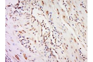 Immunohistochemistry (Paraffin-embedded Sections) (IHC (p)) image for anti-Nuclear Receptor Subfamily 4, Group A, Member 3 (NR4A3) (AA 521-626) antibody (ABIN1386602)