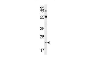 Neurogenin2 Antibody  (ABIN388769 and ABIN2839073) western blot analysis in Hela cell line lysates (35 μg/lane). (Neurogenin 2 Antikörper  (C-Term))