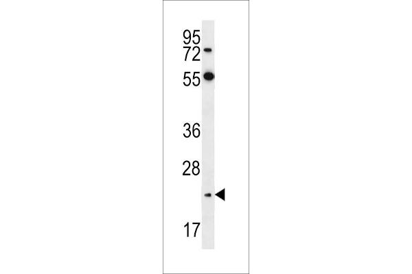 Neurogenin 2 Antikörper  (C-Term)