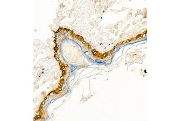 Cytokeratin 13 Antikörper  (N-Term)