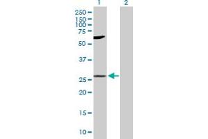 Western Blot analysis of LIN7A expression in transfected 293T cell line by LIN7A MaxPab polyclonal antibody. (LIN7A Antikörper  (AA 1-233))