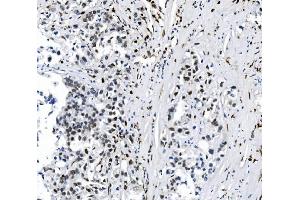 IHC analysis of SAMHD1 using anti-SAMHD1 antibody (ABIN7601515).