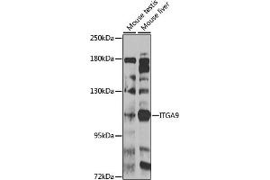 Western blot analysis of extracts of various cell lines, using ITG antibody (ABIN6133048, ABIN6142571, ABIN6142573 and ABIN6223622) at 1:1000 dilution. (ITGA9 Antikörper  (AA 30-250))
