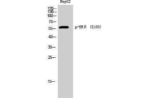 Western Blotting (WB) image for anti-Estrogen Receptor 2 (ESR2) (pSer105) antibody (ABIN3173178) (ESR2 Antikörper  (pSer105))