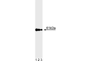 Western Blotting (WB) image for anti-Calcineurin (CAN) (AA 349-505) antibody (ABIN967510) (CAN Antikörper  (AA 349-505))