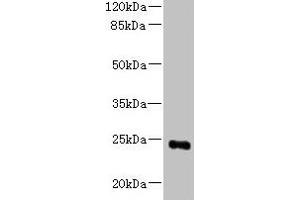 Western blot All lanes: MED18 antibody at 0. (MED18 Antikörper  (AA 35-208))