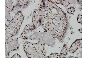 Image no. 3 for anti-AT Rich Interactive Domain 1B (SWI1-Like) (ARID1B) (AA 1364-1461) antibody (ABIN599288) (ARID1B Antikörper  (AA 1364-1461))