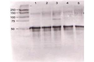 Rabbit anti-Ang-1 was used at a 1:500 dilution to detect mouse Ang-1 by western blot against supernatants of mouse angiopoietin-expressing endothelial cells. (Angiopoietin 1 Antikörper  (N-Term))
