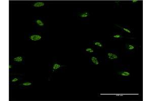 Immunofluorescence of monoclonal antibody to LHX4 on HeLa cell. (LHX4 Antikörper  (AA 291-390))