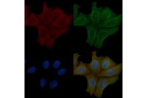 SOD1 Mouse Monoclonal Antibody staining Hela cells by IF/ICC. (SOD1 Antikörper  (Internal Region))