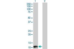 Western Blotting (WB) image for anti-Cleavage Stimulation Factor, 3' Pre-RNA, Subunit 3, 77kDa (CSTF3) (AA 1-104) antibody (ABIN598634)