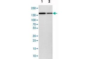 Western blot analysis of cell lysates with KIAA0355 polyclonal antibody  at 1:250-1:500 dilution. (KIAA0355 Antikörper)