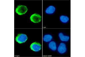Immunofluorescence staining of fixed Jurkat cells with anti-CD154 antibody IDEC-131 (Toralizumab). (Rekombinanter sCD40L (Toralizumab Biosimilar) Antikörper)