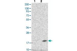 Western blot analysis of Lane 1: Negative control (vector only transfected HEK293T lysate), Lane 2: Over-expression Lysate (Co-expressed with a C-terminal myc-DDK tag (~3. (DPM3 Antikörper)