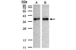 WB Image Sample(30 μg of whole cell lysate) A:A431, B:HeLa S3, 12% SDS PAGE antibody diluted at 1:500 (ZPBP Antikörper)