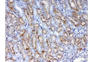 Immunohistochemistry (IHC) image for anti-Lectin, Galactoside-Binding, Soluble, 1 (LGALS1) antibody (ABIN5647567)