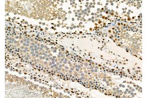 ABIN6261827 and ABIN6278382 at 1/100 staining Rat testis tissue by IHC-P. (FTO Antikörper  (C-Term))