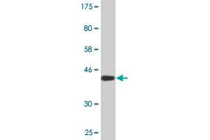 Western Blot detection against Immunogen (40. (BRD3 Antikörper  (AA 418-556))