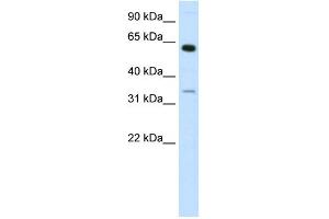 WB Suggested Anti-ZNF609 Antibody Titration: 1. (ZNF609 Antikörper  (N-Term))