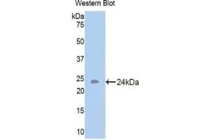 Western blot analysis of the recombinant protein. (Activin A Receptor Type IB/ALK-4 Antikörper  (AA 207-385))