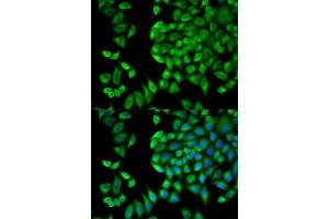 Immunofluorescence analysis of HeLa cells using WNK1 antibody. (WNK1 Antikörper  (AA 1-210))