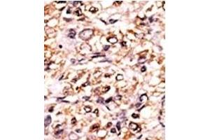 Image no. 1 for anti-Extra Spindle Poles Like 1 (ESPL1) (pSer1126) antibody (ABIN358223) (Separase Antikörper  (pSer1126))