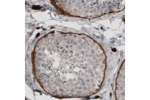 Immunohistochemical staining (Formalin-fixed paraffin-embedded sections) of human testis with LAMA1 monoclonal antibody, clone CL2968  shows strong immunoreactivity in basement membrane of seminiferous tubules.