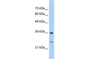 Western Blotting (WB) image for anti-Glutathione Transferase zeta 1 (Maleylacetoacetate Isomerase) (GSTZ1) antibody (ABIN2463253) (GSTZ1 Antikörper)