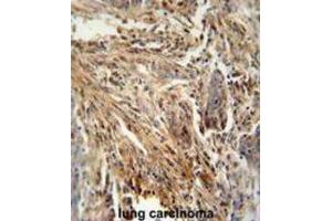 Immunohistochemistry (IHC) image for anti-Colony Stimulating Factor 2 (Granulocyte-Macrophage) (CSF2) antibody (ABIN2995782) (GM-CSF Antikörper)