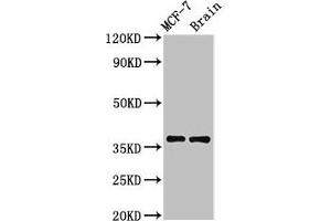 Western Blot Positive WB detected in: MCF-7 whole cell lysate, Rat brain tissue All lanes: MENT antibody at 3. (MENT (AA 24-197) Antikörper)