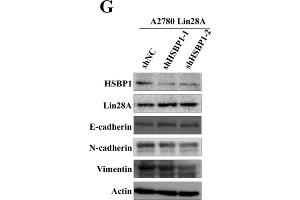 Lin28A promoted the proliferation and invasion of OC cells by up-regulating HSBP1. (beta Actin Antikörper)