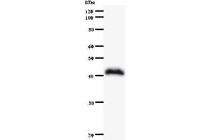 Western Blotting (WB) image for anti-SWI/SNF Related, Matrix Associated, Actin Dependent Regulator of Chromatin, Subfamily A, Member 4 (SMARCA4) antibody (ABIN930944) (SMARCA4 Antikörper)