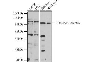 Western blot analysis of extracts of various cell lines, using CD62P/P-selectin antibody (ABIN6131514, ABIN6147503, ABIN6147506 and ABIN6218519) at 1:1000 dilution. (P-Selectin Antikörper  (AA 30-200))