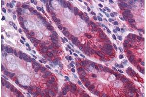 Human Small Intestine: Formalin-Fixed, Paraffin-Embedded (FFPE) (ZBED2 Antikörper  (N-Term))