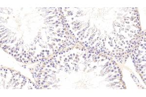 Detection of AXL in Rat Testis Tissue using Polyclonal Antibody to AXL Receptor Tyrosine Kinase (AXL) (AXL Antikörper  (AA 21-202))