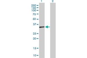 Western Blot analysis of CENPP expression in transfected 293T cell line by CENPP MaxPab polyclonal antibody. (CENPP Antikörper  (AA 1-288))