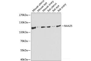 Western blot analysis of extracts of various cell lines using NAA25 Polyclonal Antibody at dilution of 1:1000. (NAA25 Antikörper)