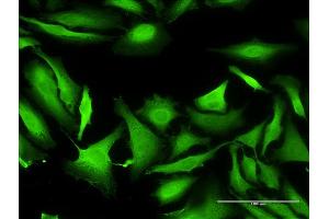 Immunofluorescence (IF) image for anti-Septin 1 (SEPT1) (AA 1-367) antibody (ABIN514987)