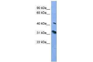 WB Suggested Anti-RHO Antibody Titration: 0. (Rho-related GTP-binding protein Antikörper  (C-Term))