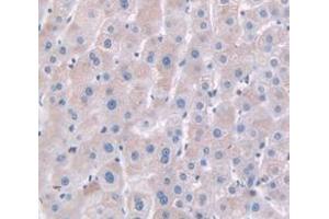 IHC-P analysis of Human Tissue, with DAB staining. (HPR Antikörper  (AA 102-347))