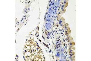 Immunohistochemistry of paraffin-embedded mouse lung using SDC2 antibody (ABIN3022587, ABIN3022588, ABIN3022589 and ABIN6218928) at dilution of 1:100 (40x lens). (Syndecan 2 Antikörper  (AA 19-144))