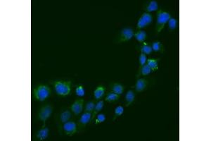 IF analysis of SEMA3B using anti-SEMA3B antibody (ABIN6719617).