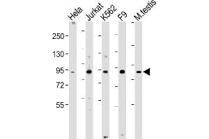 All lanes : Anti-NUP93 Antibody (N-Term) at 1:2000 dilution Lane 1: Hela whole cell lysate Lane 2: Jurkat whole cell lysate Lane 3: K562 whole cell lysate Lane 4: F9 whole cell lysate Lane 5: Mouse testis lysate Lysates/proteins at 20 μg per lane. (NUP93 Antikörper  (AA 20-54))