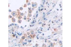 IHC-P analysis of Human Tissue, with DAB staining. (TCN2 Antikörper  (AA 19-427))