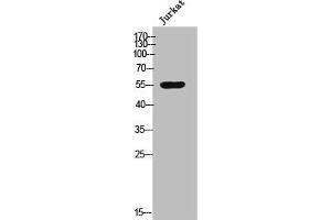 Western Blot analysis of Jurkat cells using Csk Polyclonal Antibody (CSK Antikörper  (N-Term))