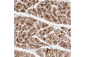 Immunohistochemical staining (Formalin-fixed paraffin-embedded sections) of human heart muscle shows strong granular positivity in myocytes. (NDUFB8 Antikörper)