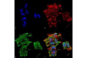Immunocytochemistry/Immunofluorescence analysis using Mouse Anti-Alpha B Crystallin Monoclonal Antibody, Clone 3A10. (CRYAB Antikörper  (FITC))