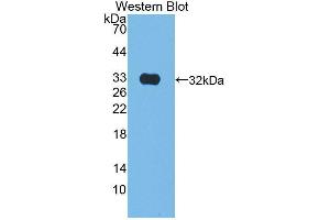 Western blot analysis of the recombinant protein. (Kallikrein 9 Antikörper  (AA 1-250))