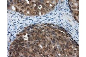 Immunohistochemical staining of paraffin-embedded Kidney tissue using anti-LIPG mouse monoclonal antibody. (LIPG Antikörper)